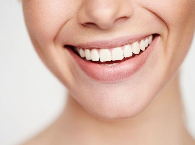 Como deixar os dentes retor