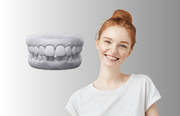 Tratamento para dentes separados ou diastema com Invisalign