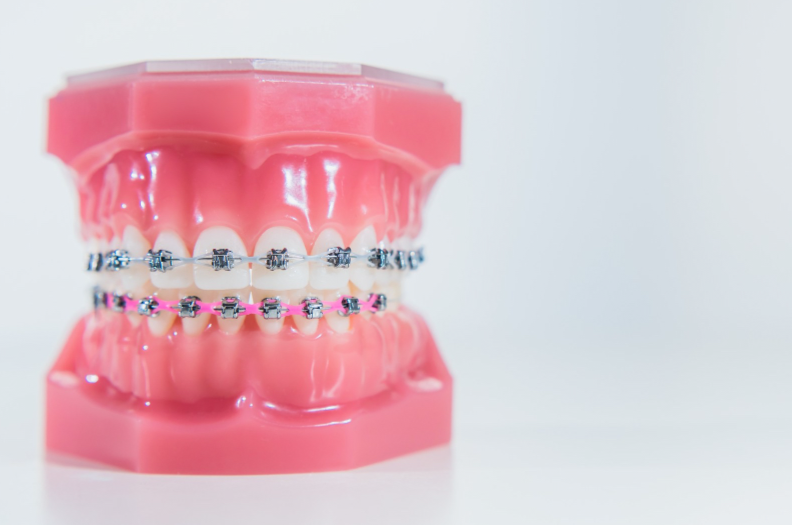 A importância de tratar os dentes de crianças e adolescentes.