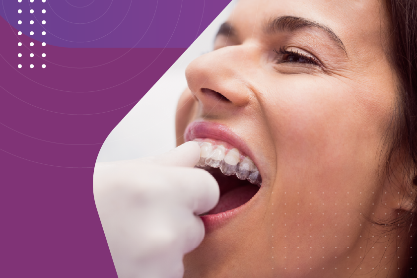 invisalign-uso-continuo-sucesso-tratamento