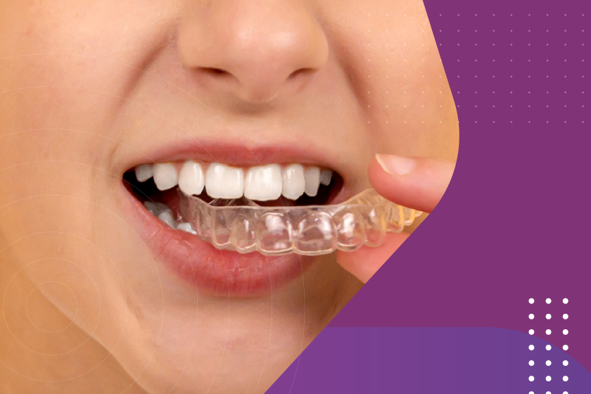invisalign-uso-continuo-sucesso-tratamento