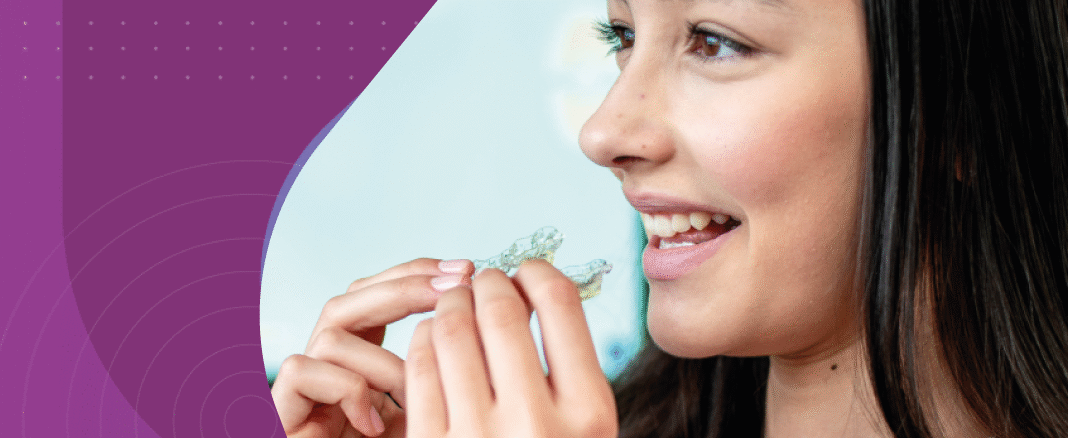 invisalign occlusal blocks controle da mordida