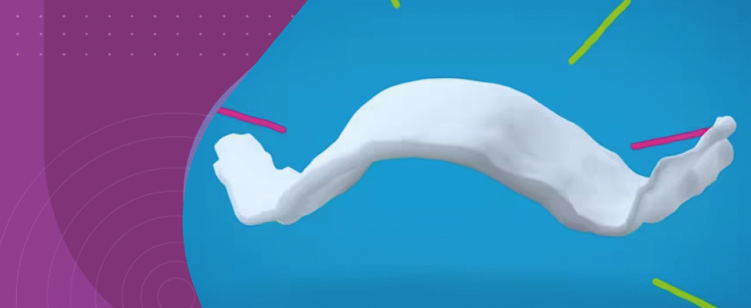 expansão palatina infantil aparelho expansor