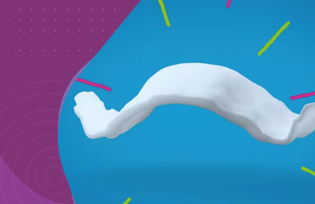 expansão palatina infantil aparelho expansor