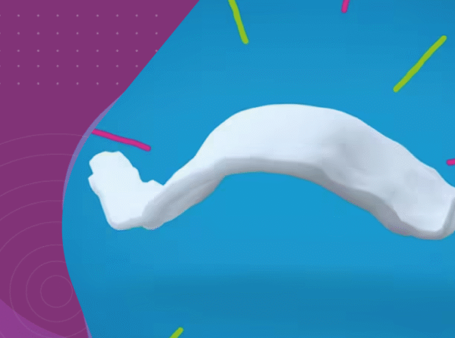 expansão palatina infantil aparelho expansor