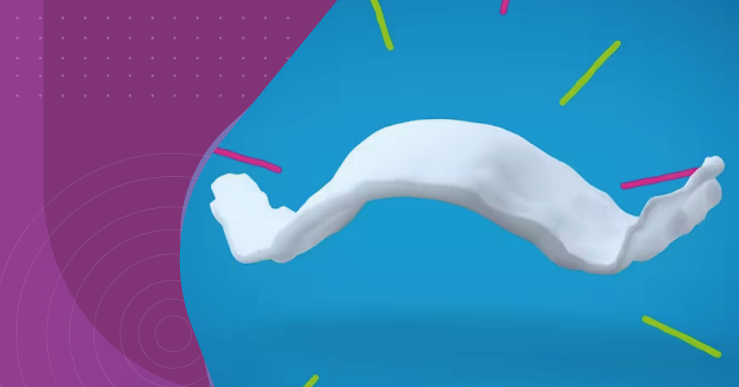 expansão palatina infantil aparelho expansor